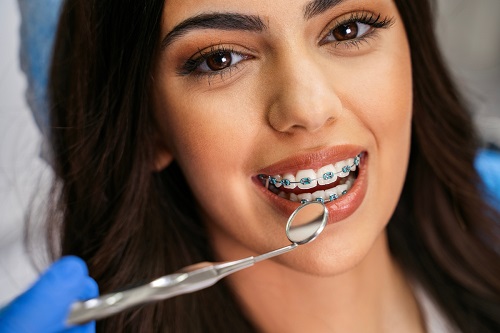 Dental Braces Treatment